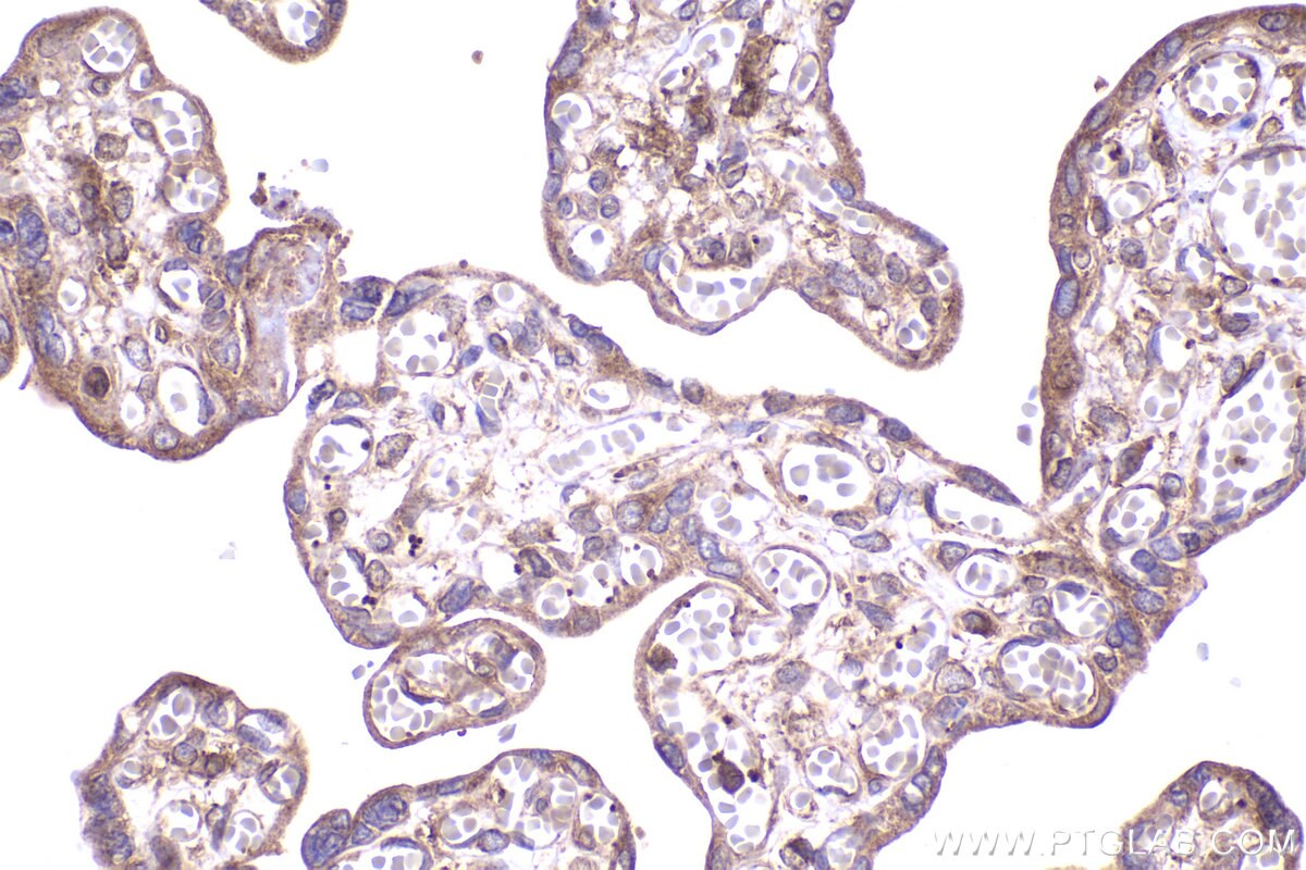 Immunohistochemical analysis of paraffin-embedded human placenta tissue slide using KHC2337 (RAB10 IHC Kit).