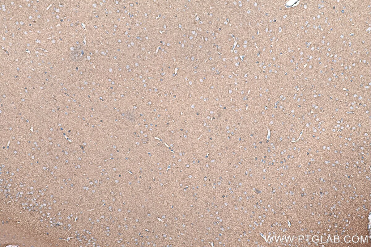 Immunohistochemical analysis of paraffin-embedded mouse brain tissue slide using KHC0861 (RAB14 IHC Kit).