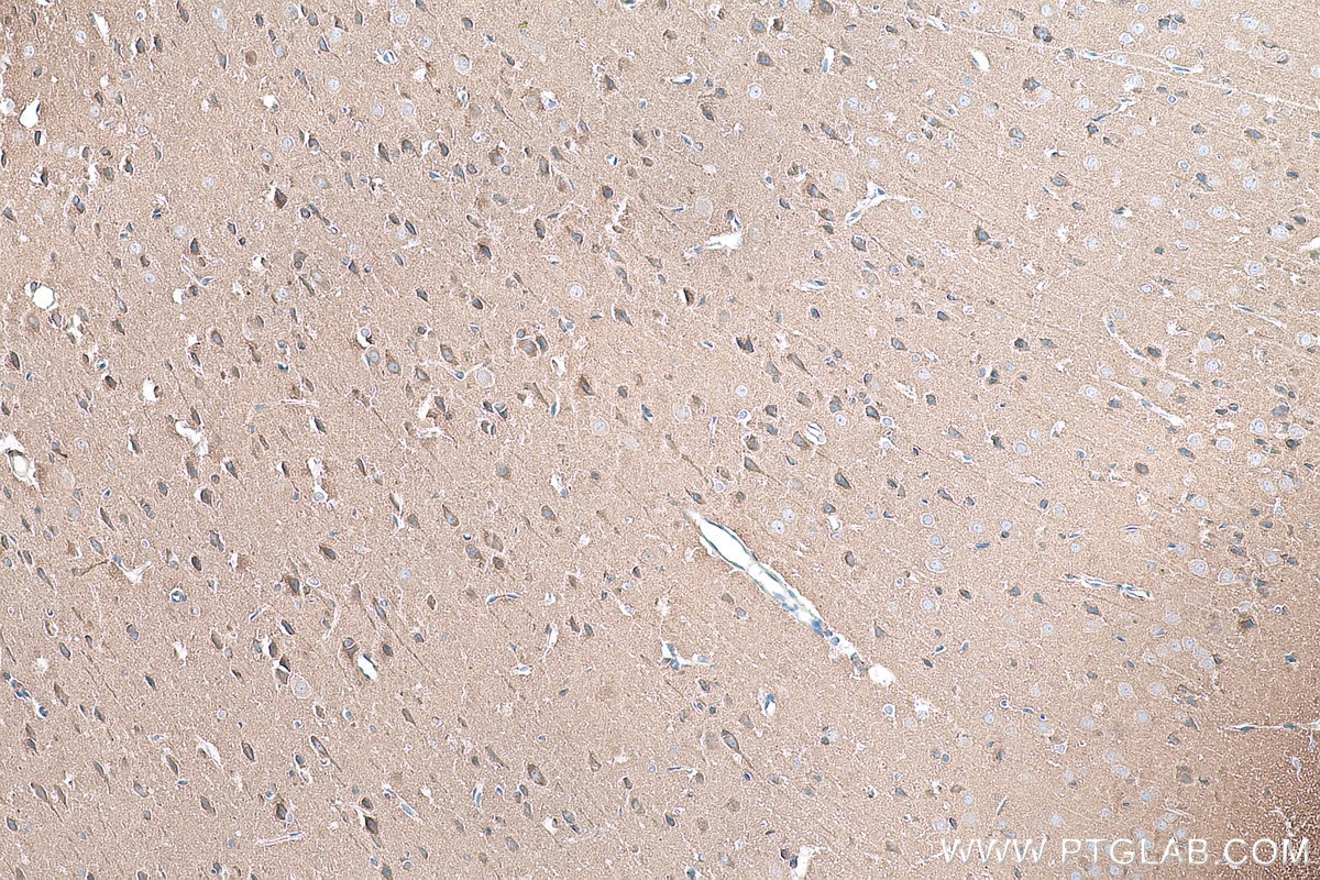 Immunohistochemical analysis of paraffin-embedded rat brain tissue slide using KHC0861 (RAB14 IHC Kit).