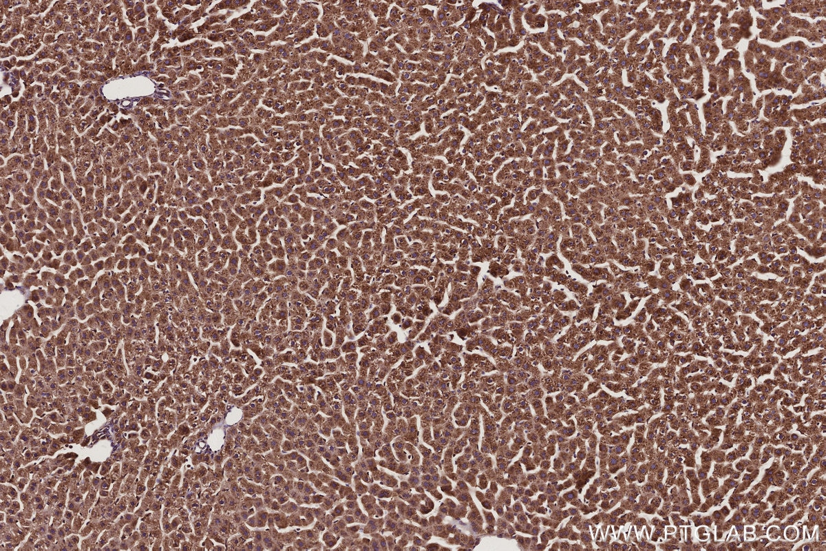 Immunohistochemical analysis of paraffin-embedded rat liver tissue slide using KHC2935 (RAB18 IHC Kit).