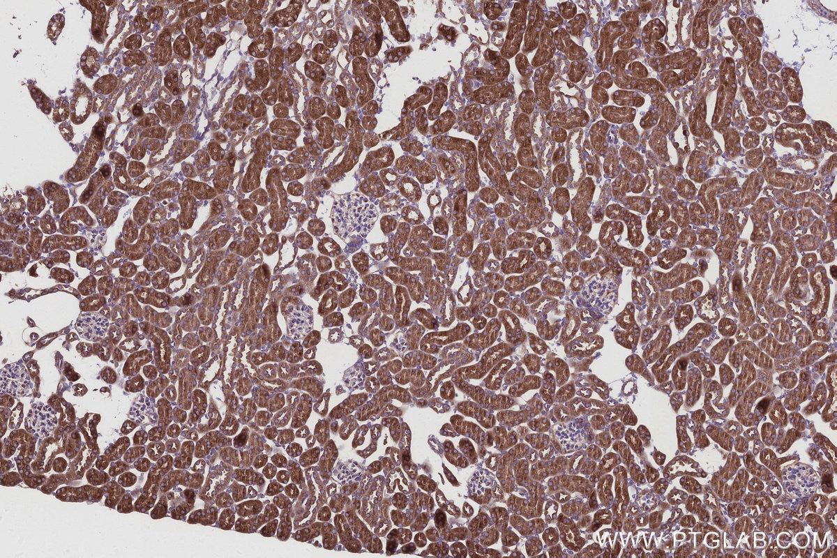 Immunohistochemical analysis of paraffin-embedded mouse kidney tissue slide using KHC2935 (RAB18 IHC Kit).