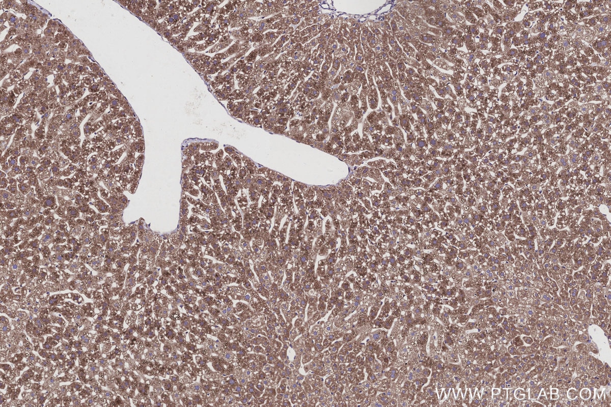 Immunohistochemical analysis of paraffin-embedded mouse liver tissue slide using KHC2935 (RAB18 IHC Kit).