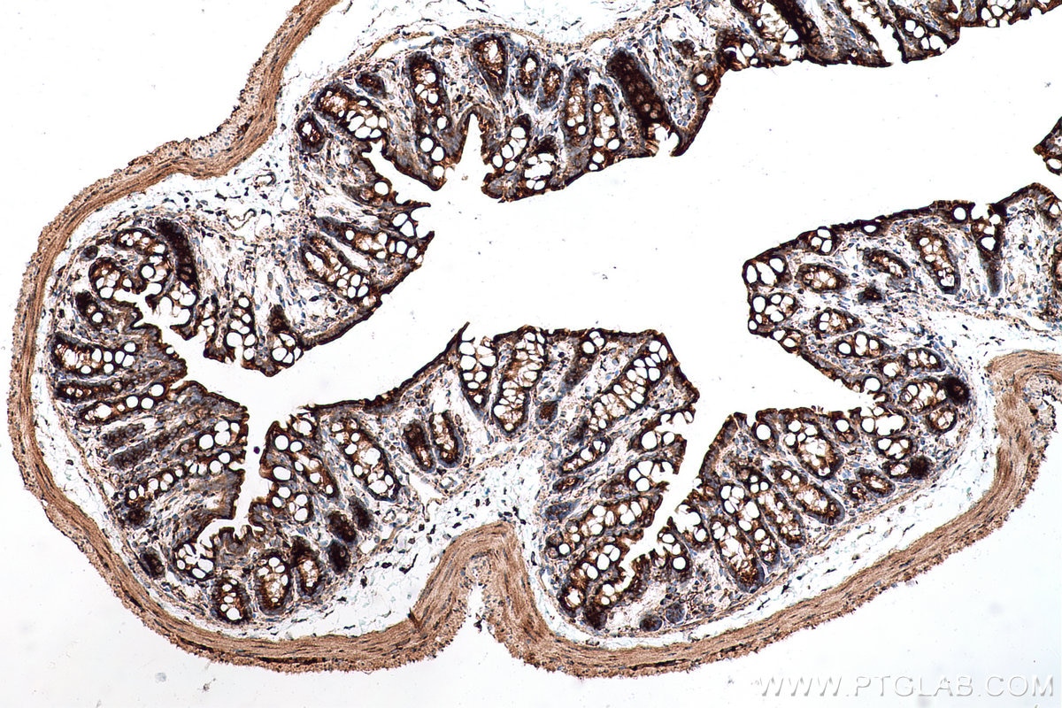 Immunohistochemical analysis of paraffin-embedded mouse colon tissue slide using KHC0689 (RAB1A IHC Kit).