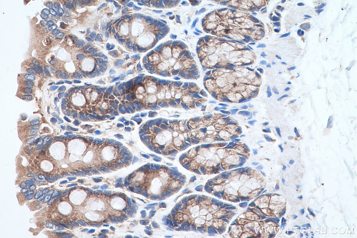 Immunohistochemical analysis of paraffin-embedded rat colon tissue slide using KHC0689 (RAB1A IHC Kit).