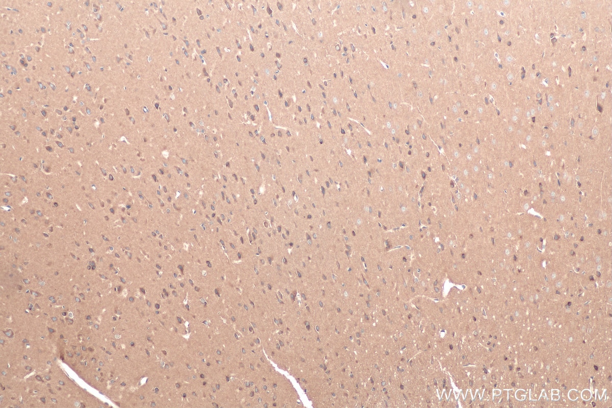 Immunohistochemical analysis of paraffin-embedded rat brain tissue slide using KHC0838 (RAB1B IHC Kit).