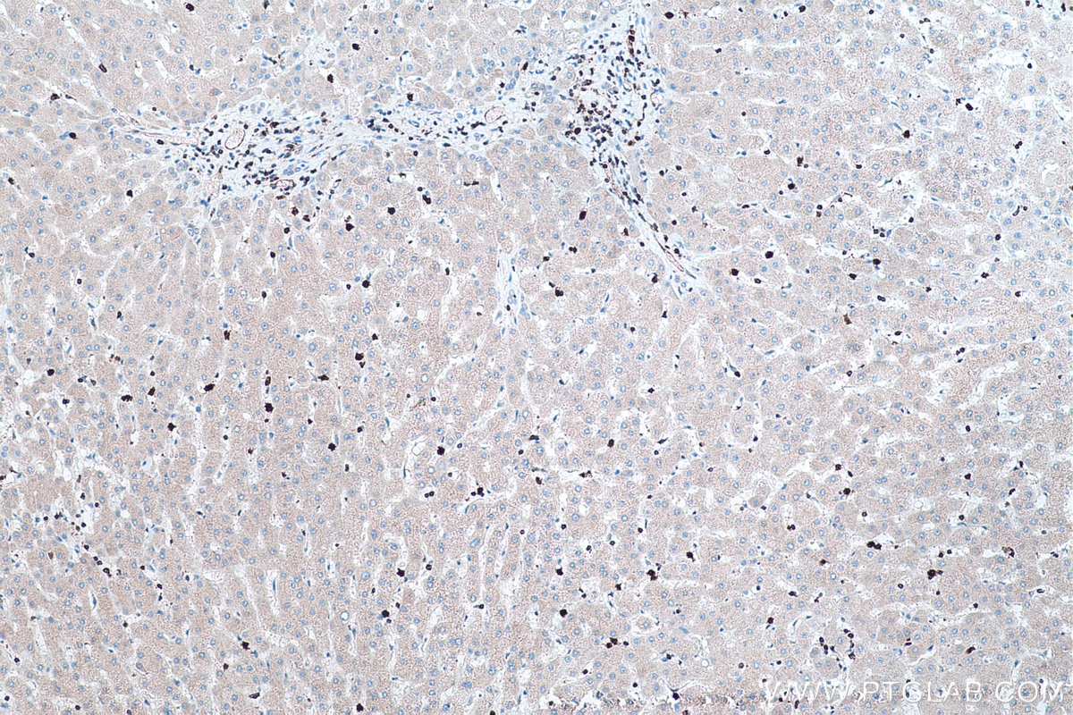 Immunohistochemical analysis of paraffin-embedded human liver tissue slide using KHC0450 (RAB27A IHC Kit).