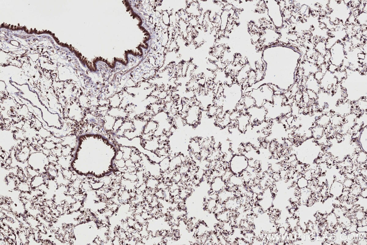 Immunohistochemical analysis of paraffin-embedded rat lung tissue slide using KHC2732 (RAB2B IHC Kit).