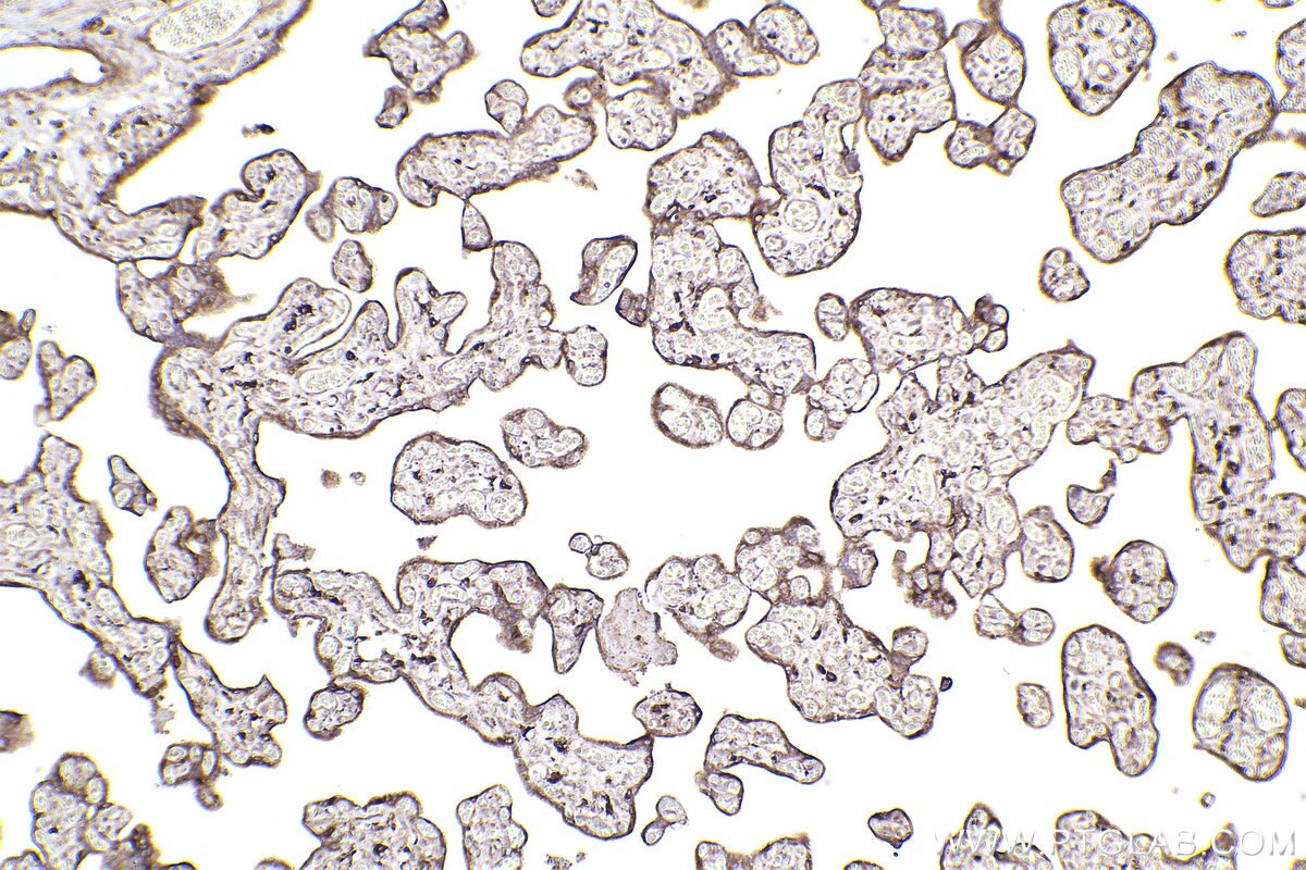 Immunohistochemical analysis of paraffin-embedded human placenta tissue slide using KHC2440 (RAB31 IHC Kit).