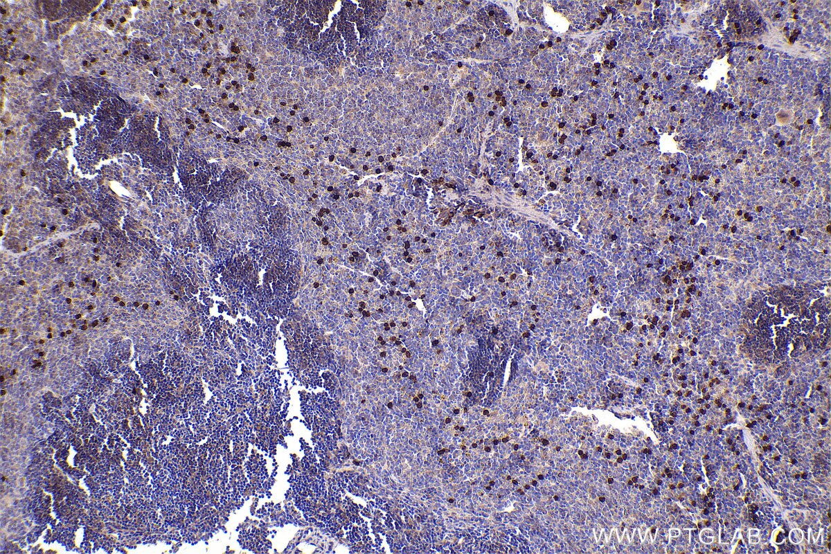 Immunohistochemical analysis of paraffin-embedded mouse spleen tissue slide using KHC2440 (RAB31 IHC Kit).