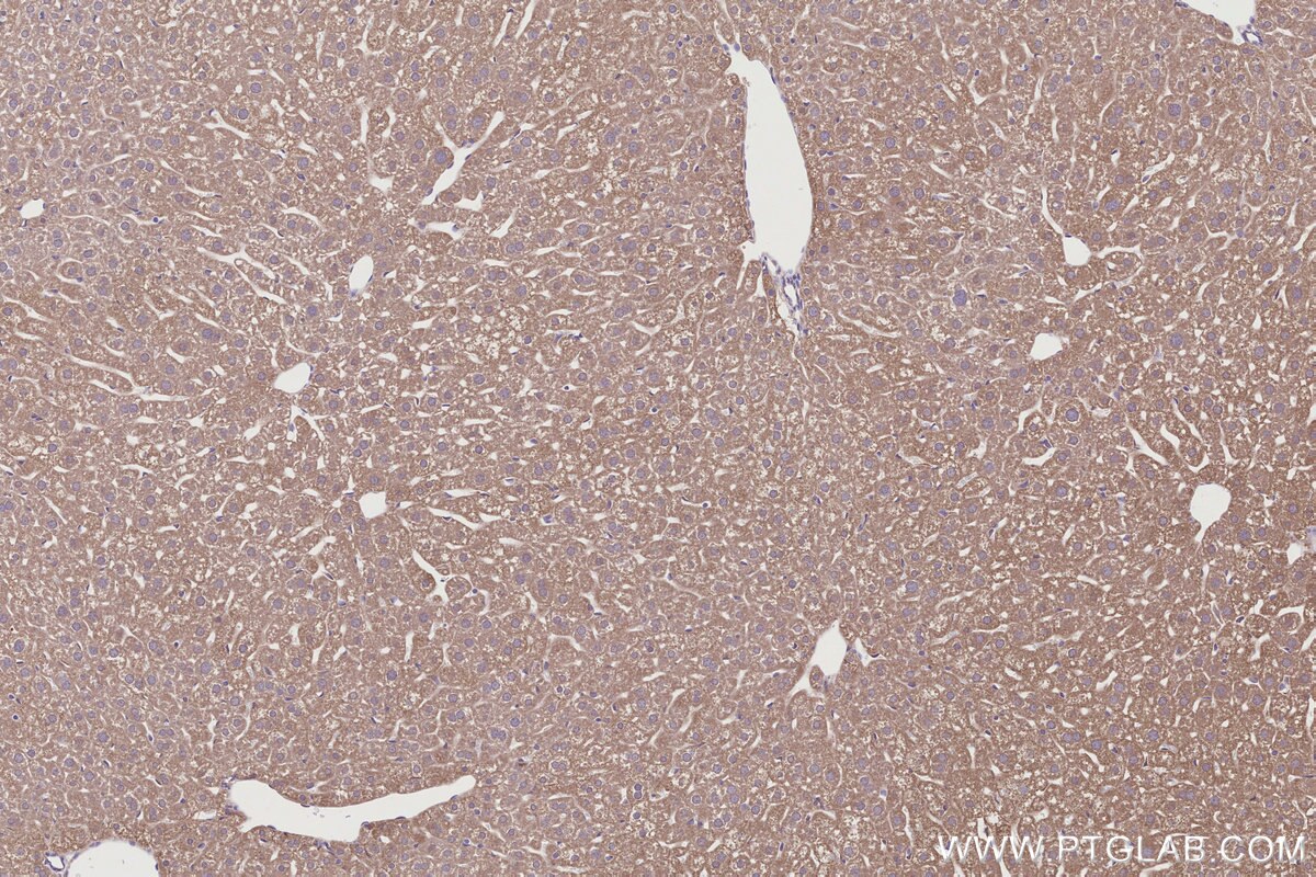 Immunohistochemical analysis of paraffin-embedded mouse liver tissue slide using KHC2785 (RAB39B IHC Kit).