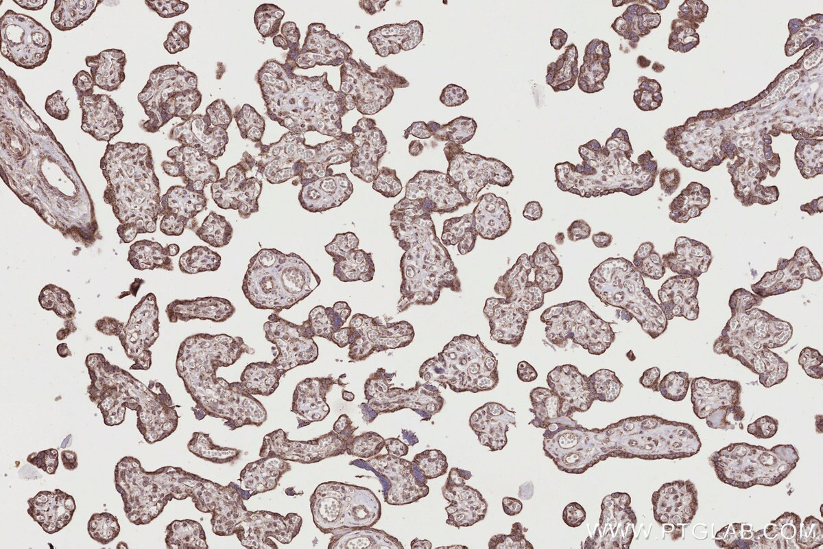 Immunohistochemical analysis of paraffin-embedded human placenta tissue slide using KHC2785 (RAB39B IHC Kit).