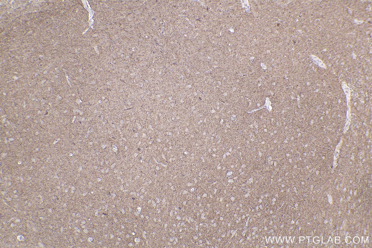 Immunohistochemical analysis of paraffin-embedded rat brain tissue slide using KHC2202 (RAB3B/C IHC Kit).