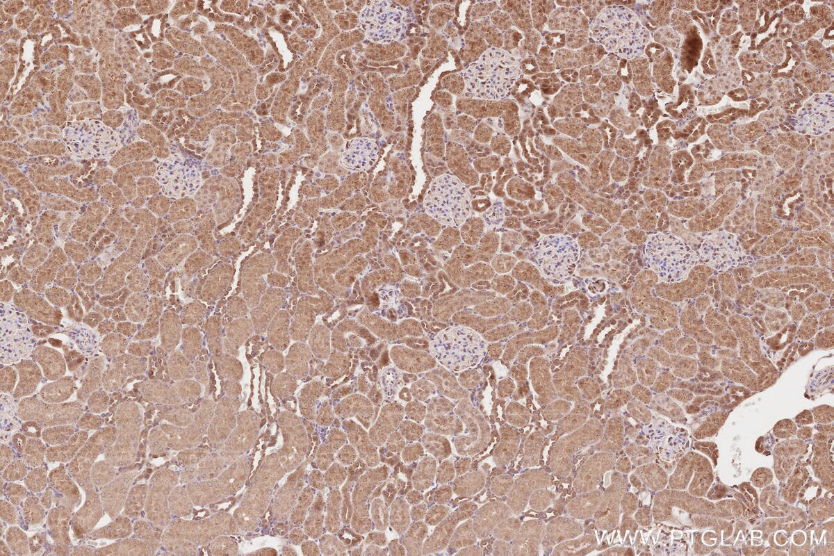 Immunohistochemical analysis of paraffin-embedded rat kidney tissue slide using KHC2640 (RAB43 IHC Kit).