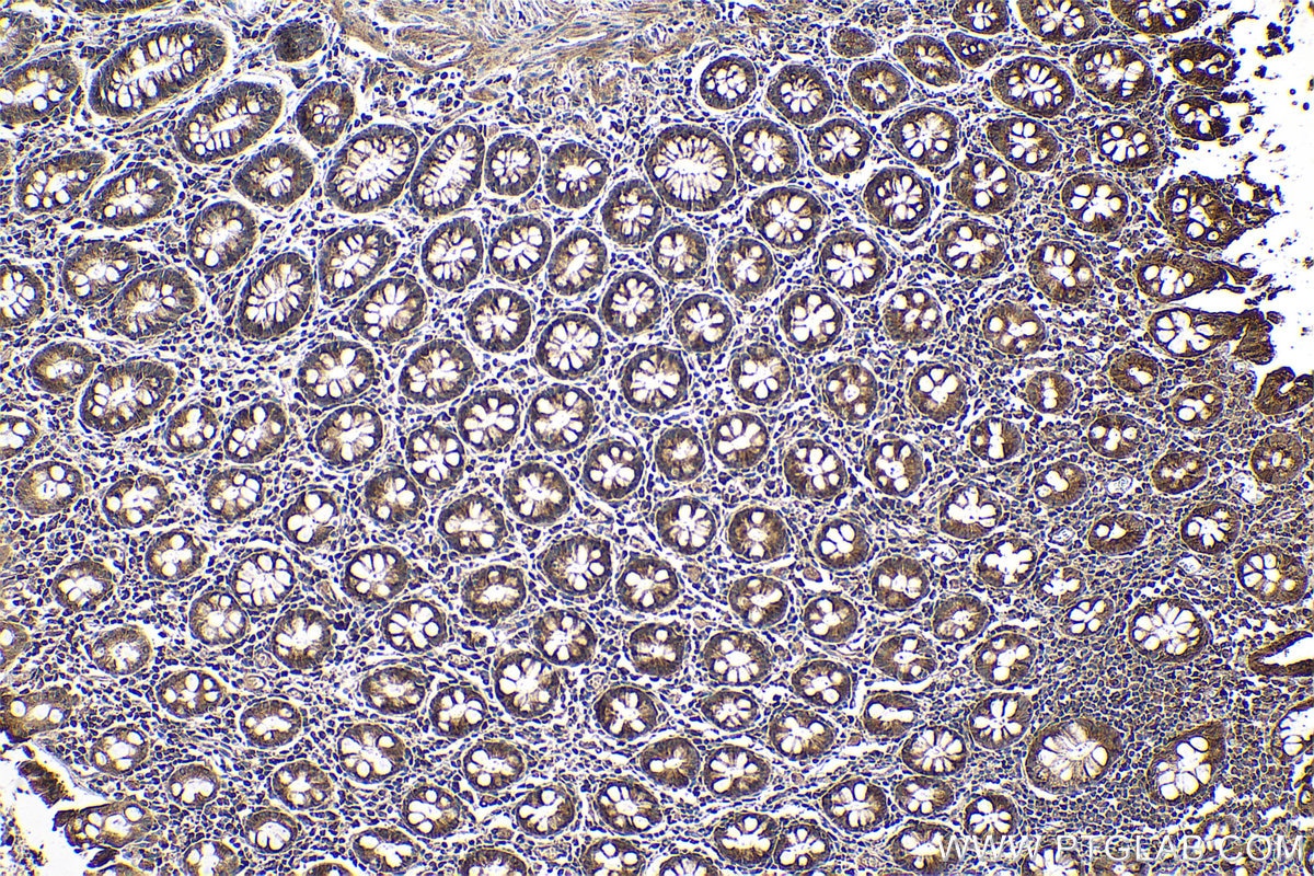 Immunohistochemical analysis of paraffin-embedded human colon tissue slide using KHC0700 (RAB7A IHC Kit).