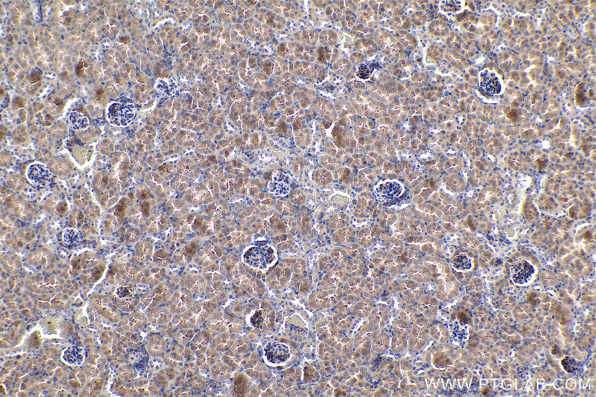 Immunohistochemical analysis of paraffin-embedded mouse kidney tissue slide using KHC0700 (RAB7A IHC Kit).