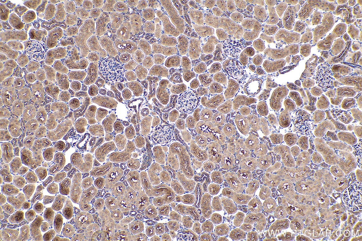 Immunohistochemical analysis of paraffin-embedded rat kidney tissue slide using KHC0700 (RAB7A IHC Kit).