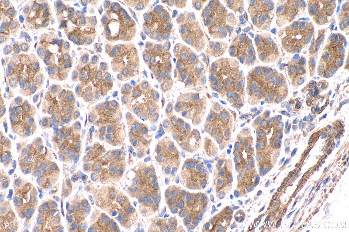 Immunohistochemical analysis of paraffin-embedded rat stomach tissue slide using KHC0700 (RAB7A IHC Kit).