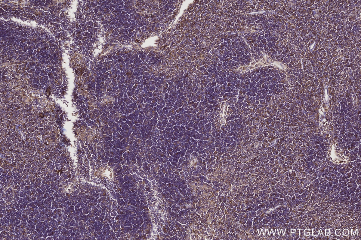 Immunohistochemical analysis of paraffin-embedded mouse thymus tissue slide using KHC2766 (RAB8 IHC Kit).