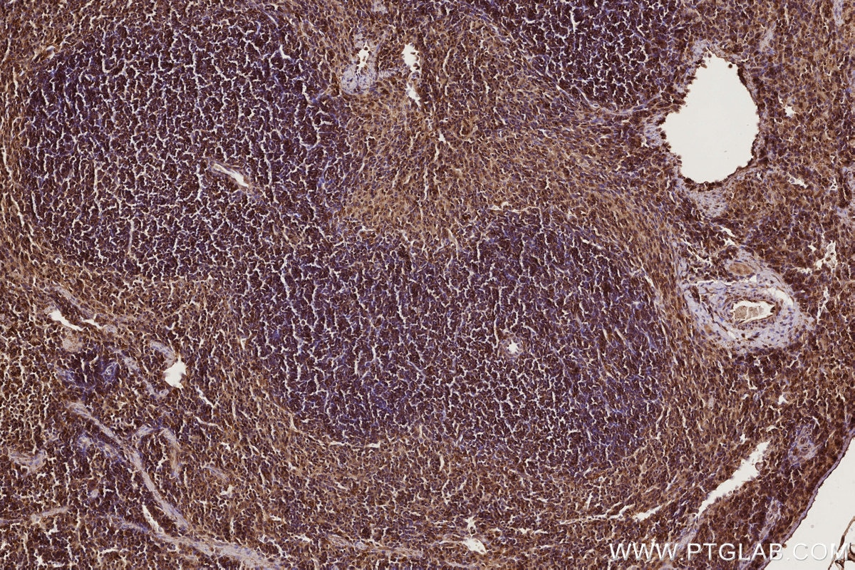 Immunohistochemical analysis of paraffin-embedded mouse spleen tissue slide using KHC2766 (RAB8 IHC Kit).