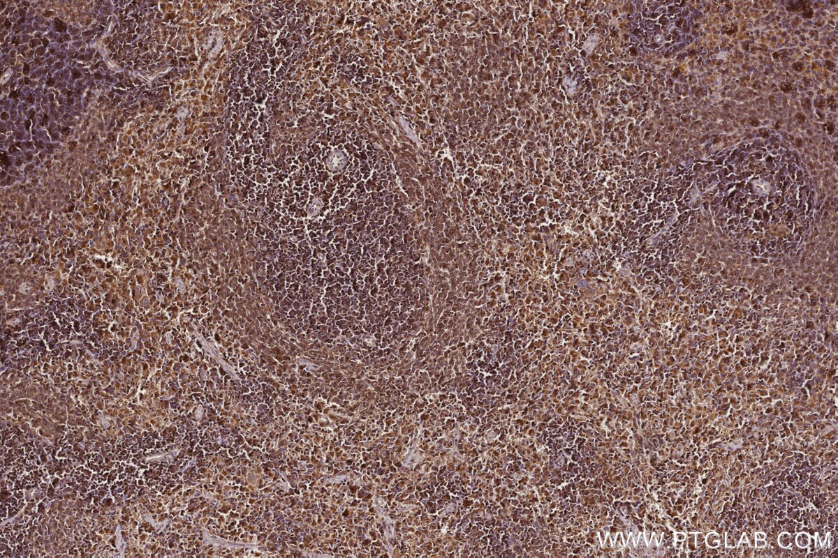 Immunohistochemical analysis of paraffin-embedded rat spleen tissue slide using KHC2766 (RAB8 IHC Kit).