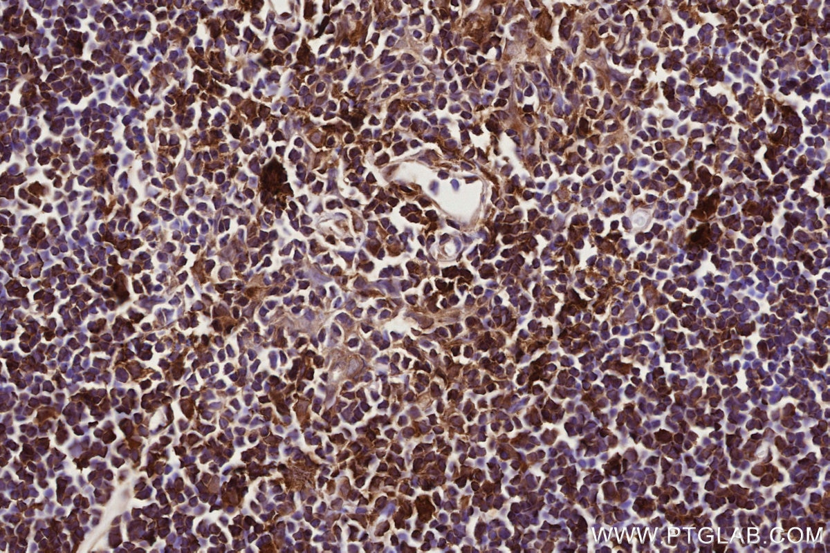 Immunohistochemical analysis of paraffin-embedded rat thymus tissue slide using KHC2766 (RAB8 IHC Kit).