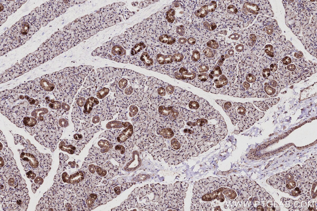 Immunohistochemical analysis of paraffin-embedded rat salivary gland tissue slide using KHC2936 (RAB9B IHC Kit).