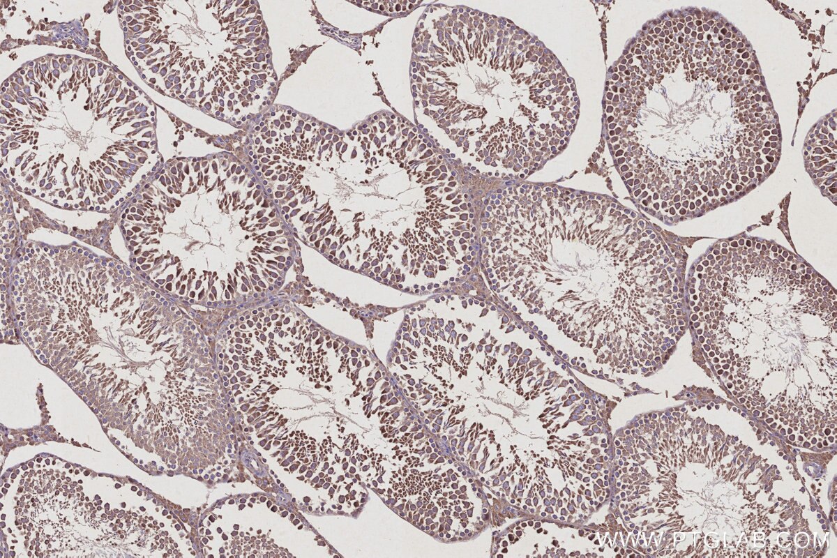 Immunohistochemical analysis of paraffin-embedded rat testis tissue slide using KHC2936 (RAB9B IHC Kit).