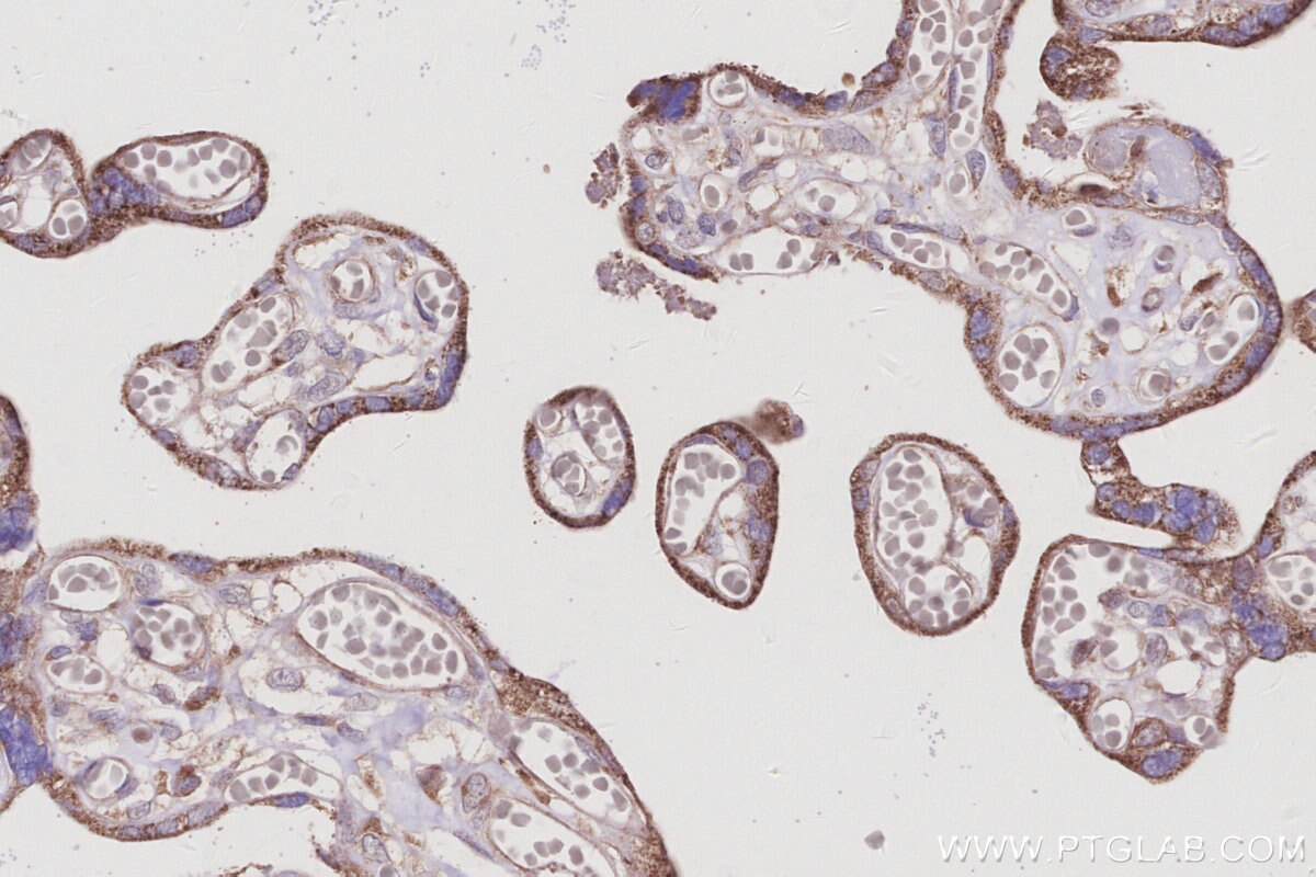 Immunohistochemical analysis of paraffin-embedded human placenta tissue slide using KHC3015 (RABGEF1 IHC Kit).
