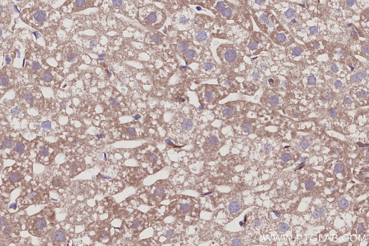 Immunohistochemical analysis of paraffin-embedded mouse liver tissue slide using KHC3015 (RABGEF1 IHC Kit).