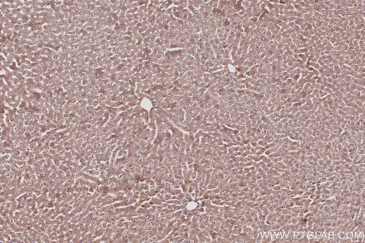 Immunohistochemical analysis of paraffin-embedded rat liver tissue slide using KHC3015 (RABGEF1 IHC Kit).