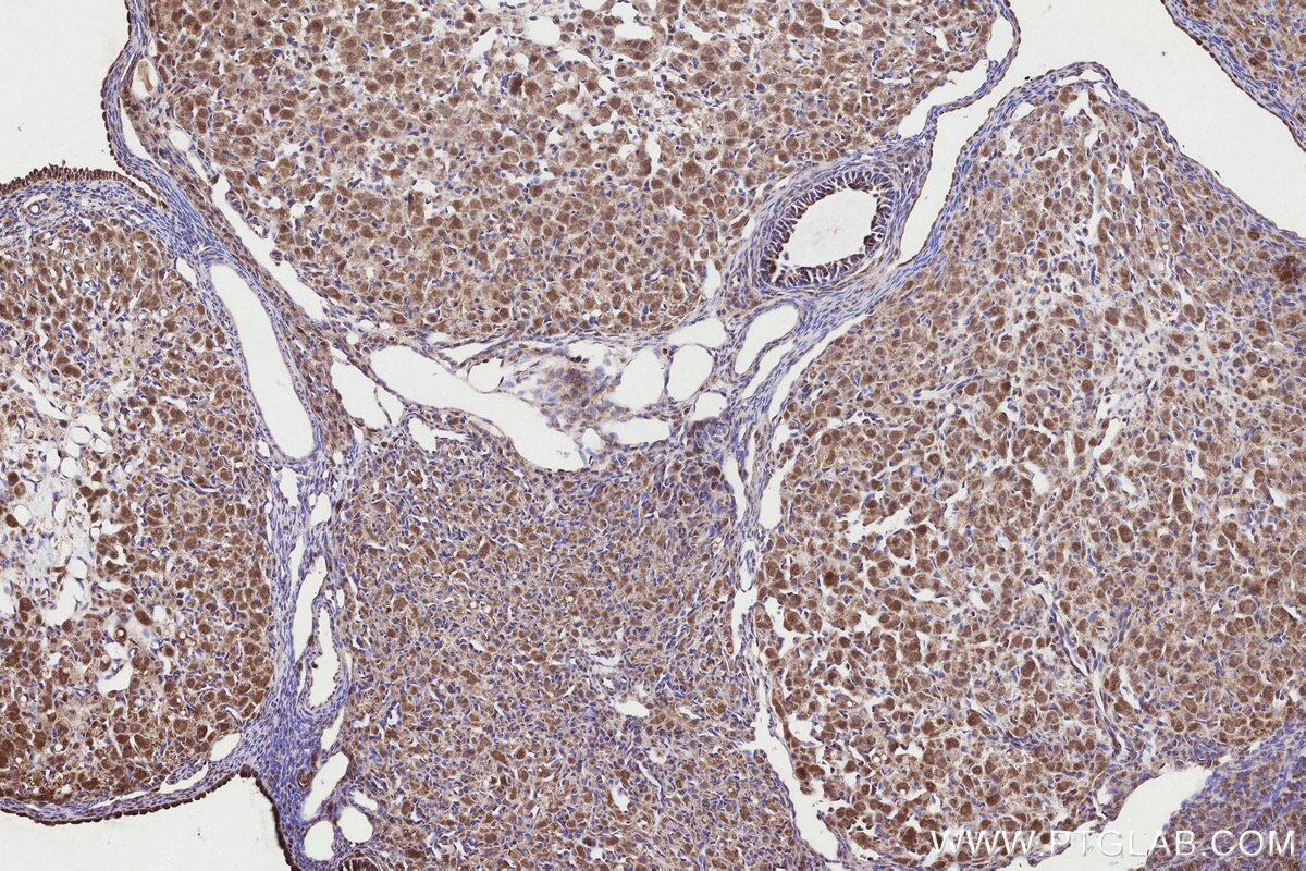 Immunohistochemical analysis of paraffin-embedded rat ovary tissue slide using KHC3307 (RABGGTA IHC Kit).