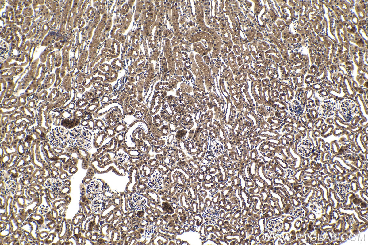 Immunohistochemical analysis of paraffin-embedded mouse kidney tissue slide using KHC1629 (RAD23B IHC Kit).