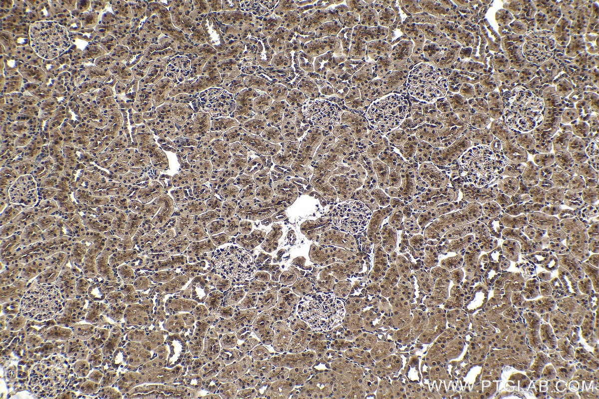 Immunohistochemical analysis of paraffin-embedded rat kidney tissue slide using KHC1629 (RAD23B IHC Kit).