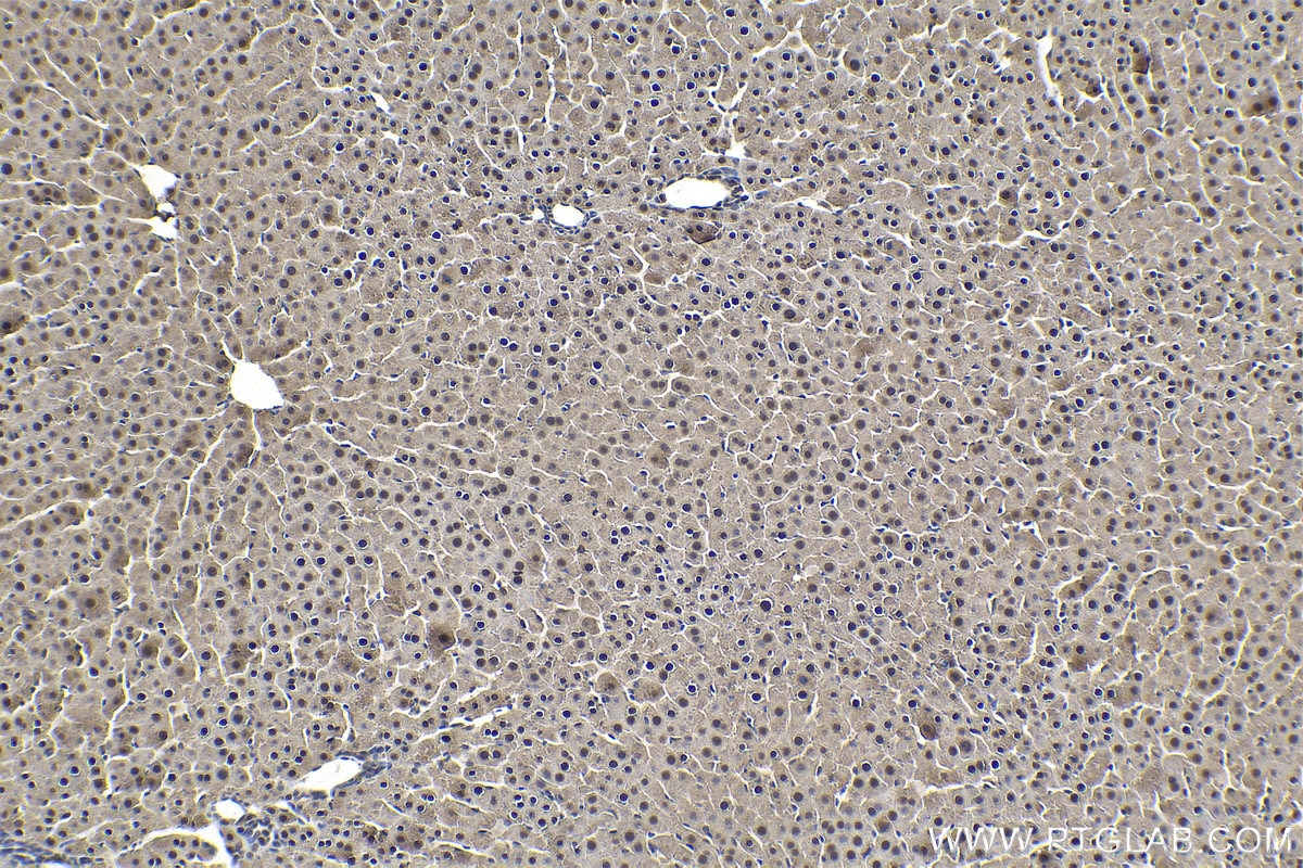 Immunohistochemical analysis of paraffin-embedded rat liver tissue slide using KHC1629 (RAD23B IHC Kit).