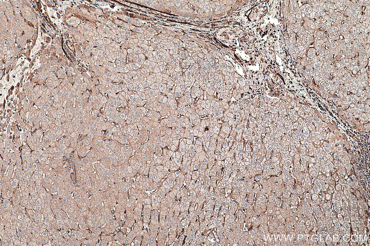 Immunohistochemical analysis of paraffin-embedded human liver tissue slide using KHC0271 (RALB IHC Kit).