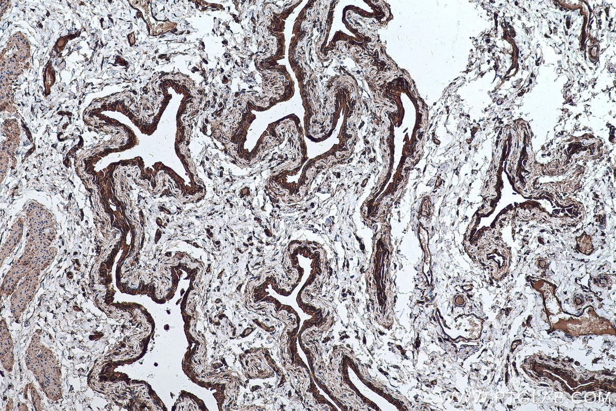 Immunohistochemical analysis of paraffin-embedded mouse bladder tissue slide using KHC0271 (RALB IHC Kit).