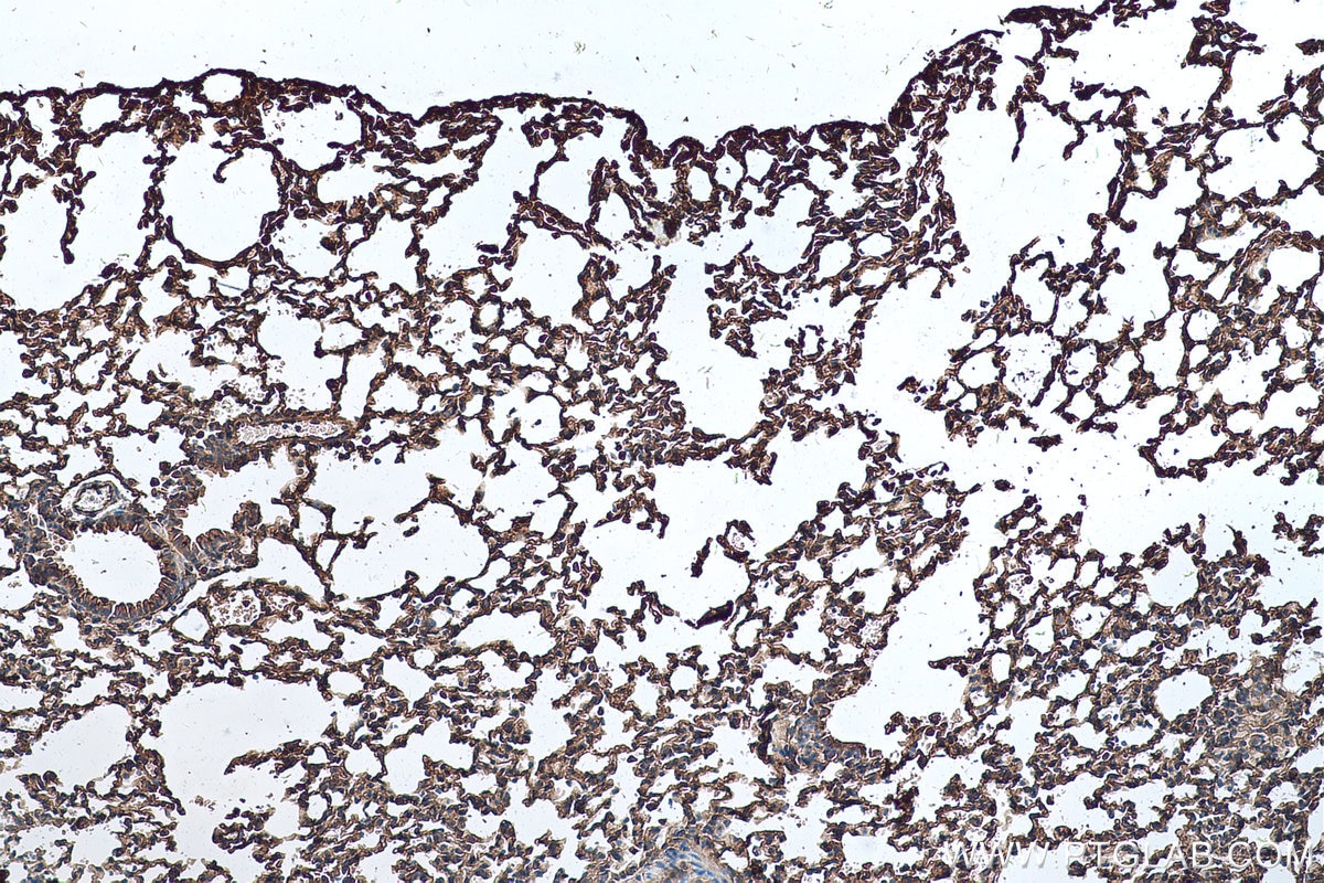 Immunohistochemical analysis of paraffin-embedded mouse lung tissue slide using KHC0271 (RALB IHC Kit).