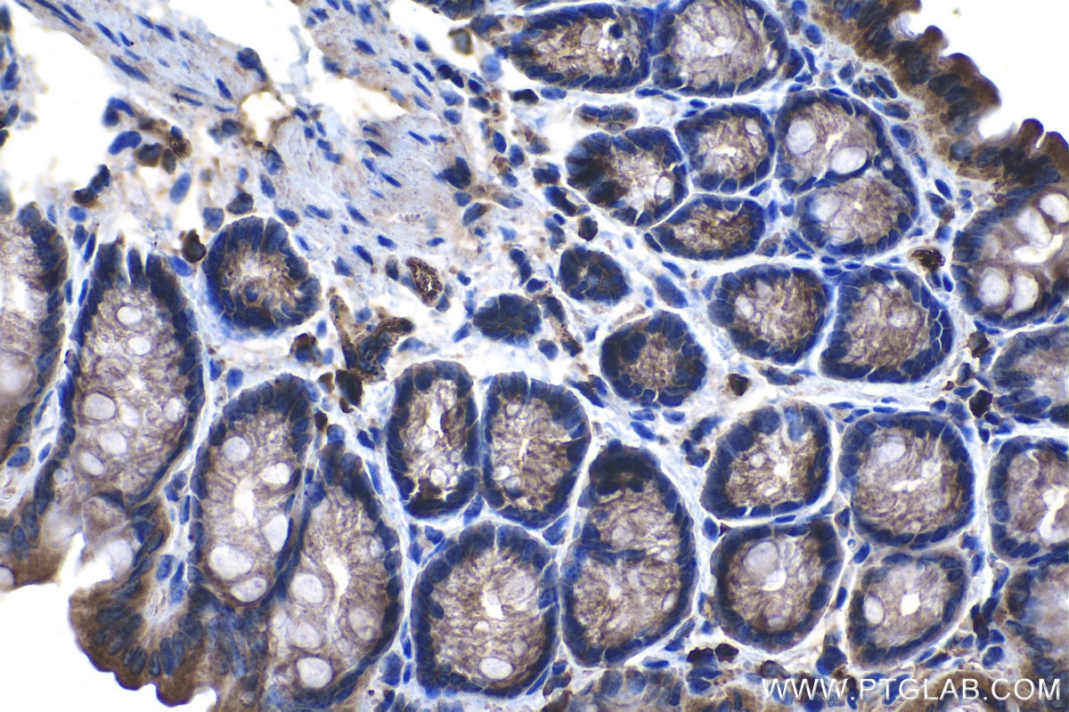 Immunohistochemical analysis of paraffin-embedded mouse colon tissue slide using KHC1320 (RALBP1 IHC Kit).