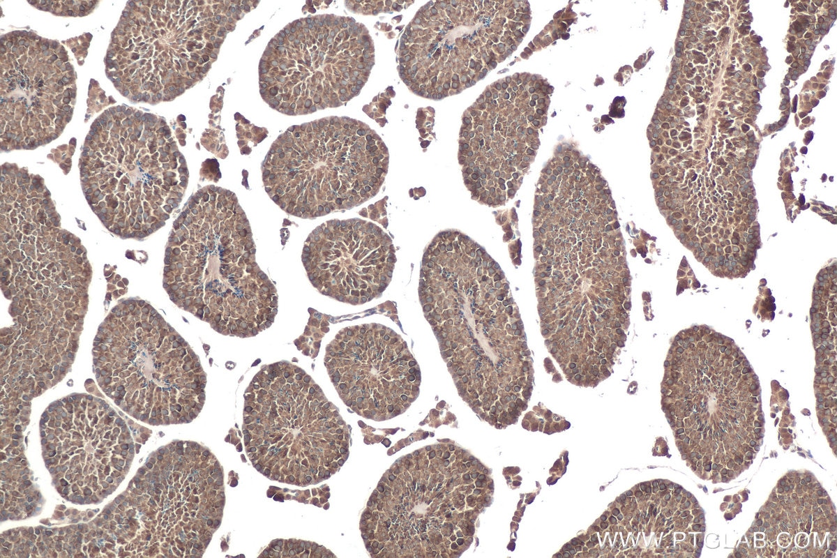 Immunohistochemical analysis of paraffin-embedded mouse testis tissue slide using KHC0881 (RANBP1 IHC Kit).