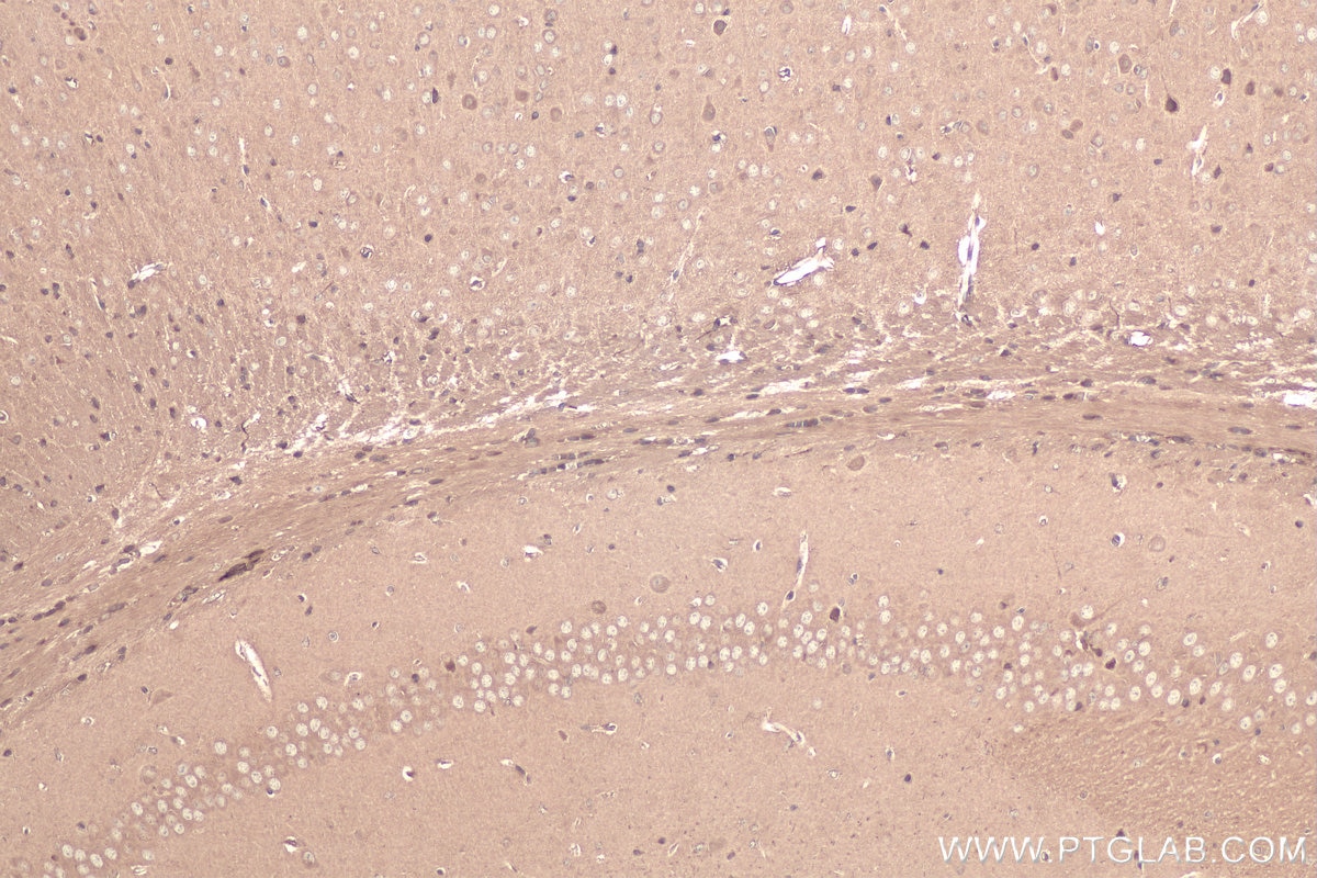 Immunohistochemical analysis of paraffin-embedded mouse brain tissue slide using KHC0881 (RANBP1 IHC Kit).