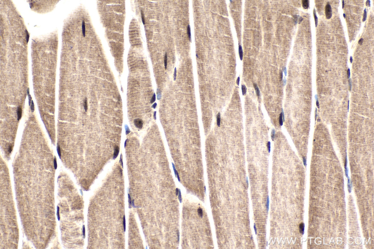 Immunohistochemical analysis of paraffin-embedded mouse skeletal muscle tissue slide using KHC1793 (RANBP10 IHC Kit).