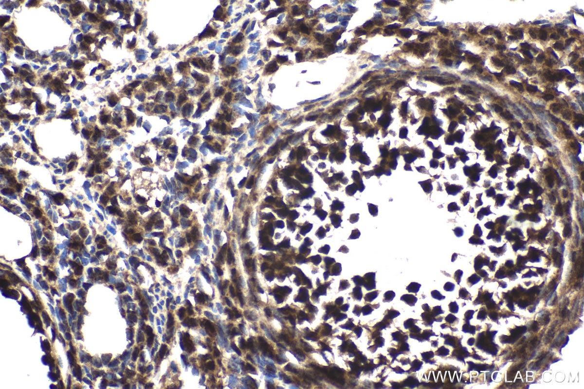 Immunohistochemical analysis of paraffin-embedded mouse ovary tissue slide using KHC1793 (RANBP10 IHC Kit).
