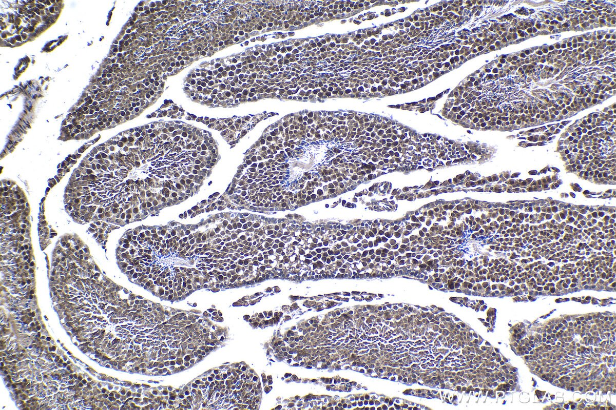 Immunohistochemical analysis of paraffin-embedded mouse testis tissue slide using KHC1041 (RANBP9 IHC Kit).