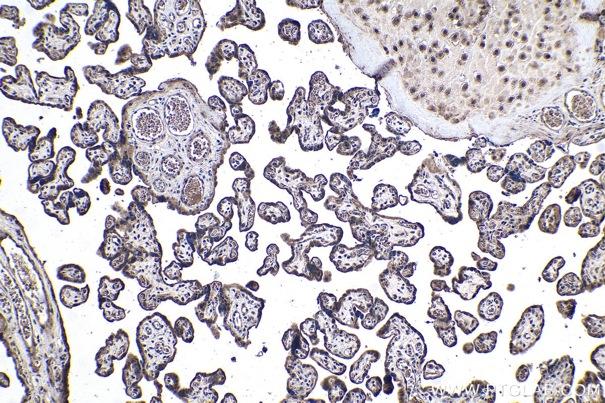 Immunohistochemical analysis of paraffin-embedded human placenta tissue slide using KHC1041 (RANBP9 IHC Kit).