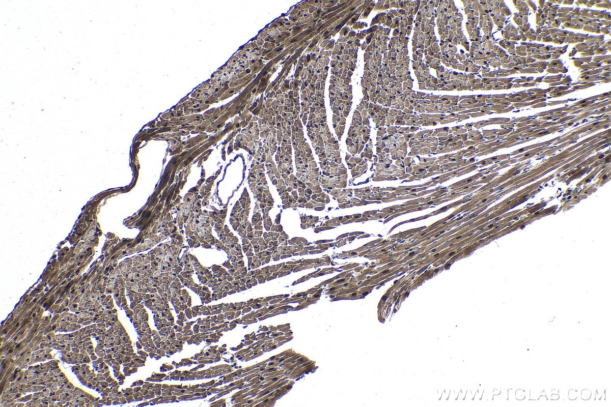 Immunohistochemical analysis of paraffin-embedded mouse heart tissue slide using KHC1041 (RANBP9 IHC Kit).