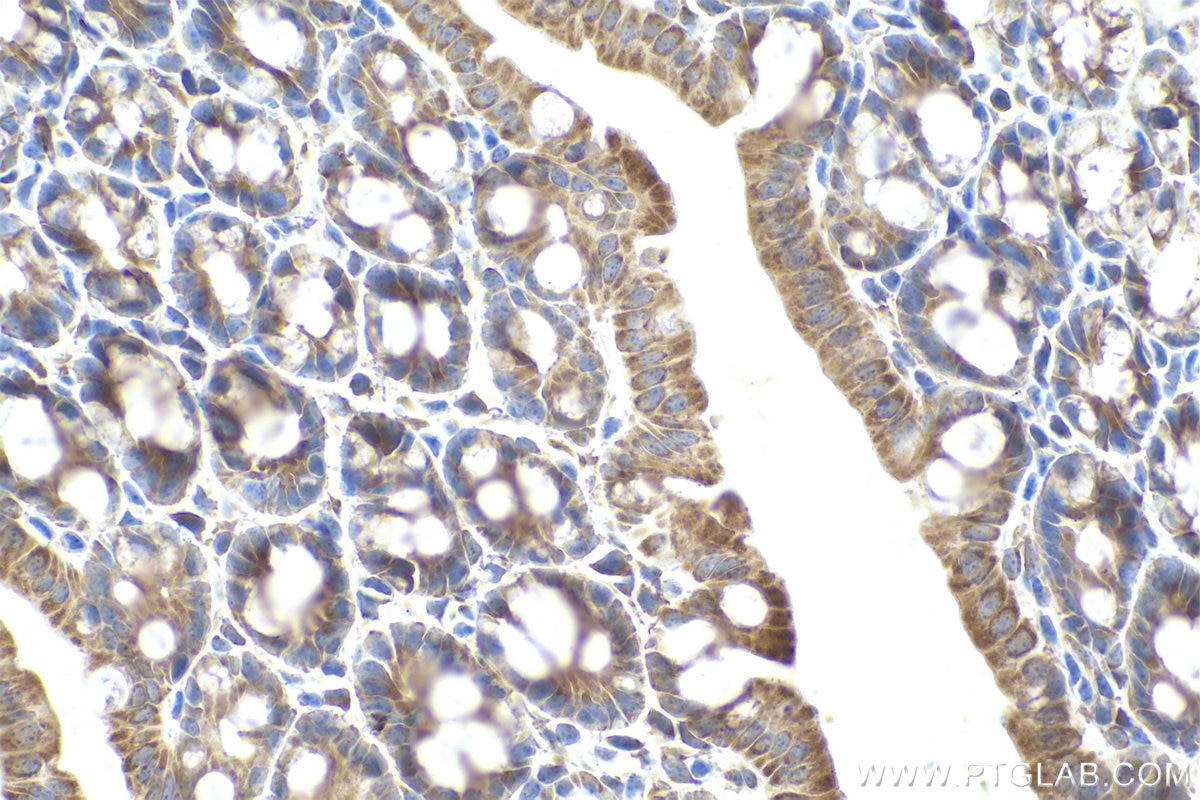 Immunohistochemical analysis of paraffin-embedded mouse colon tissue slide using KHC0922 (RAP1GDS1 IHC Kit).