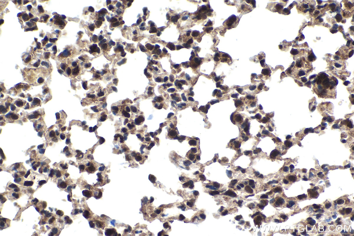 Immunohistochemical analysis of paraffin-embedded mouse lung tissue slide using KHC1521 (RARA IHC Kit).