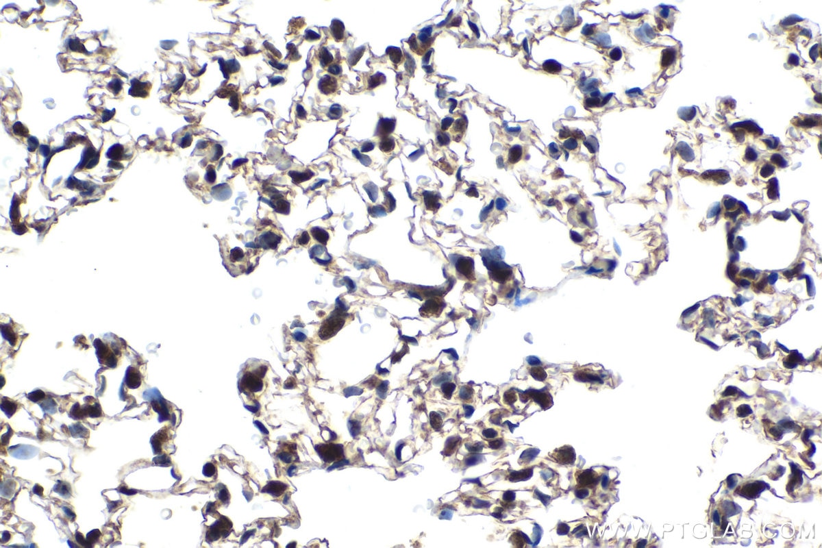 Immunohistochemical analysis of paraffin-embedded rat lung tissue slide using KHC1521 (RARA IHC Kit).