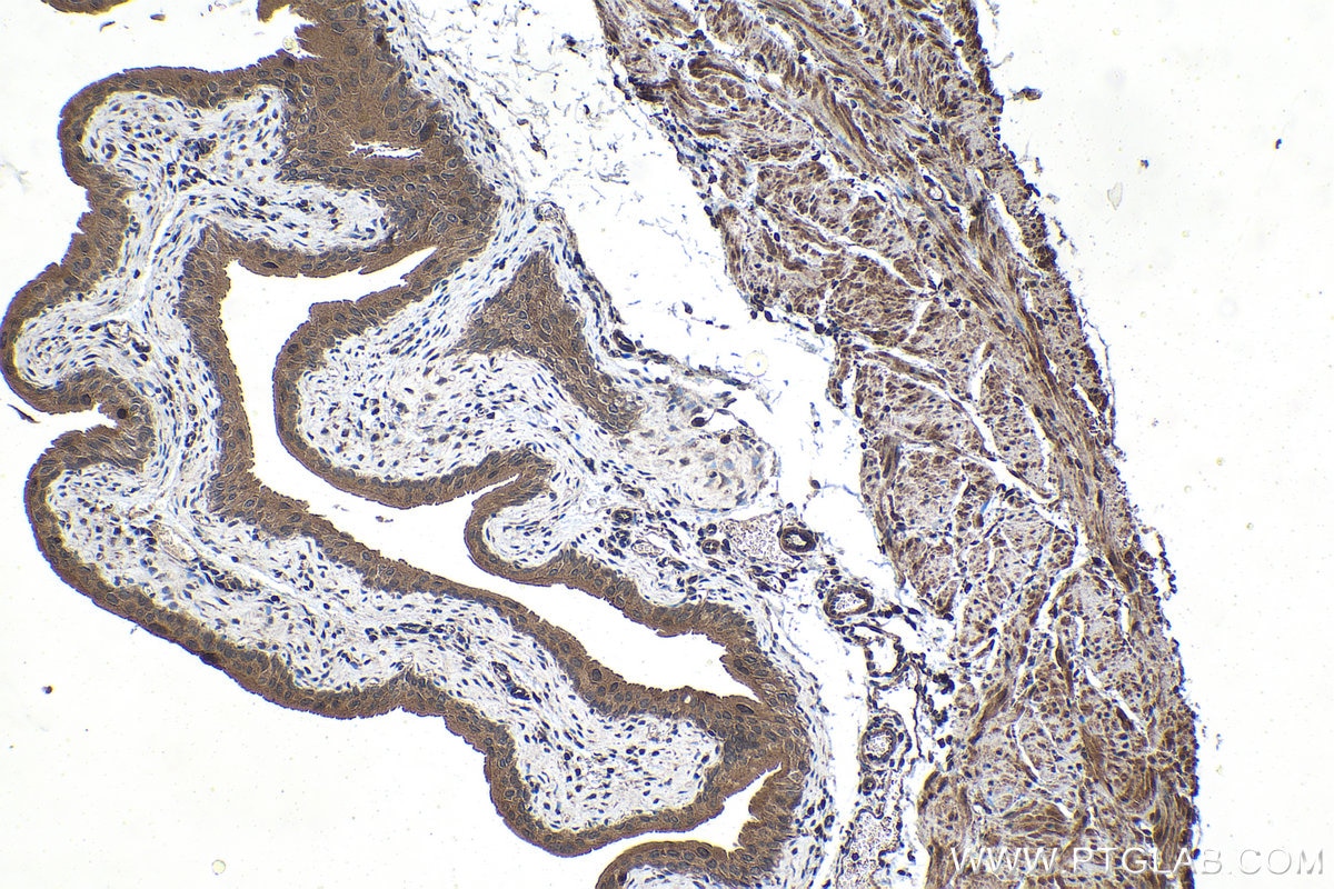 Immunohistochemical analysis of paraffin-embedded mouse bladder tissue slide using KHC1522 (RARB IHC Kit).