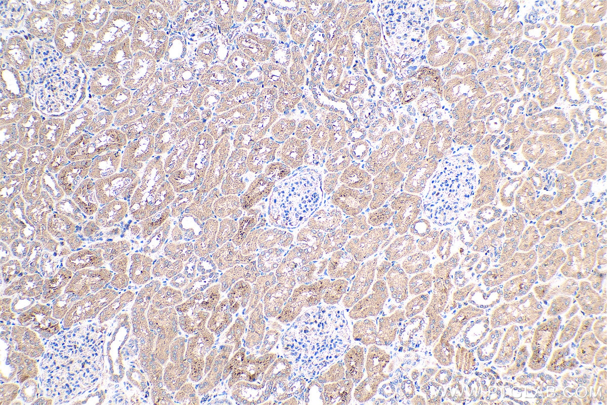 Immunohistochemical analysis of paraffin-embedded human kidney tissue slide using KHC0452 (RARRES2 IHC Kit).